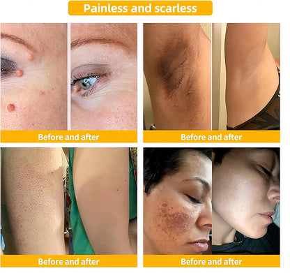 Bee Venom Skin Treatment Cream